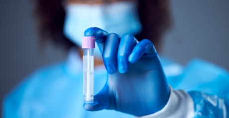 Teste PCR de Saliva SARS-CoV-2
