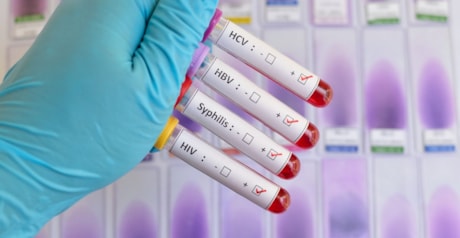 Análise Hepatites, HIV e Sifílis